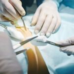 Восстановление после операции на позвоночнике поясничного отдела