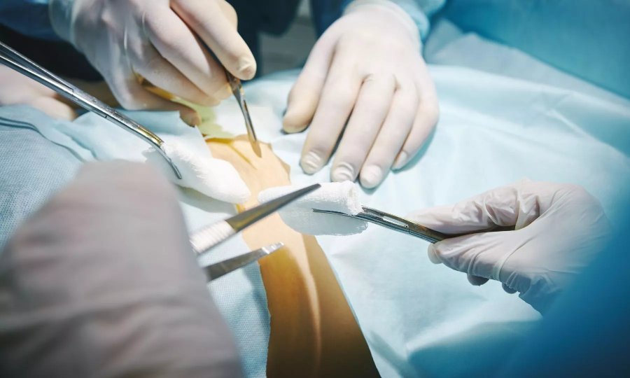 Восстановление после операции на позвоночнике поясничного отдела