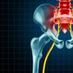 Тазовое Дно и Рассеянный Склероз