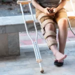 Физиотерапия после переломов